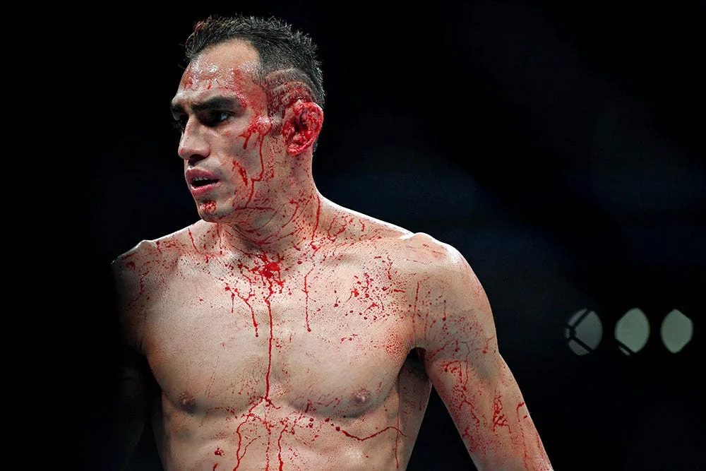 Tony Ferguson emotional over Misfits Boxing win after mothers death